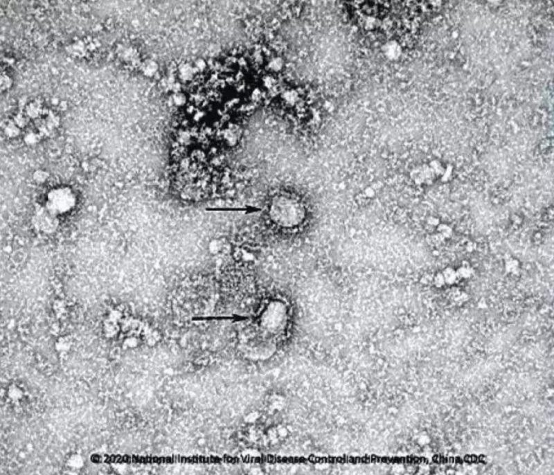 ▲新型冠狀病毒武漢株01。照片來源：國家病原微生物資源庫（中國疾病預防控制中心病毒病預防控制所）